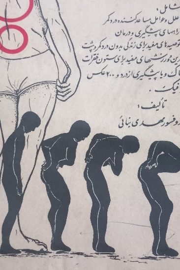 دردهای کمر و پشت