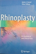 Rhinoplasty